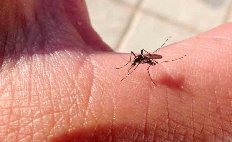 zikavirus